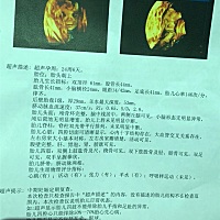 四维彩超  哪位大神能看出男宝还是女宝