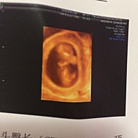 能看出来是男孩还是女孩吗