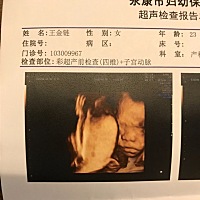顺利通过四维 会看数据分析男宝女宝的宝妈吗 第一胎好奇