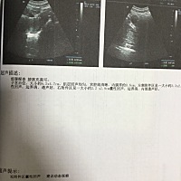 有问题吗？懂的帮忙看一下