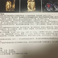 很好奇是男宝还是女宝，有会看的吗？