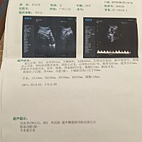 猜猜男孩女孩