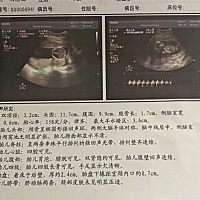 15 5天，可以看男女吗？就是好奇！老公想要闺女，还跟我打赌哈哈哈