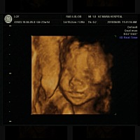 大家看看四维像男孩还是女孩