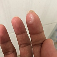 排卵日同房第六天流出乳白色的分泌物怎么回事