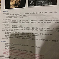 男孩还是女孩🤔🤔期待