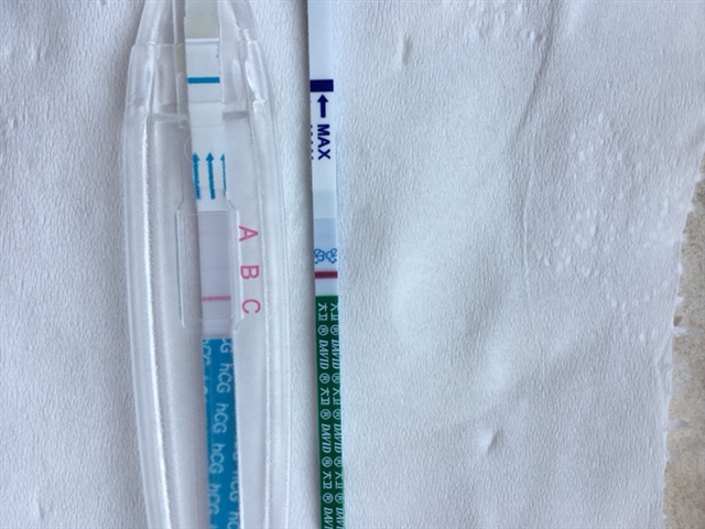 帮忙看一下什么情况 眼瞎了快