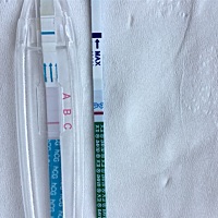 帮忙看一下什么情况 眼瞎了快