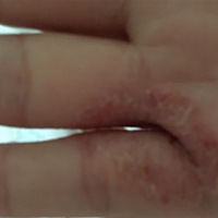 谁能告诉我这是长的啥？不痛不痒