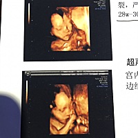 今天四维过了，大家帮忙看看男宝还是女宝呀😄😄纯属好奇