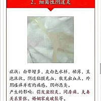 2、瘙痒和皮疹 　　外阴红肿、发痒，很可能患上了外阴皮炎，这是一种过敏性反应，刺激源可以是任何东西...
