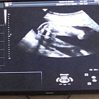 大家看看这是什么？是鸡鸡吗？