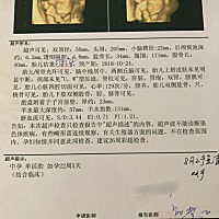 大家帮忙看看是男宝还是女宝？想知道提前给准备东西😄
