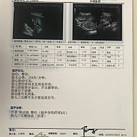 亲们帮忙看看男孩女孩呀？哈哈