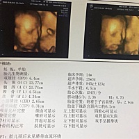 谁能告诉我是男孩还是女孩呀。 想要女宝。