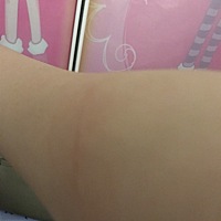 今天被家里的小猫抓了，猫比较小，狂犬针还没打，隔着衣服当时抓出了一条血丝，现在用肥皂水洗了，怎么...