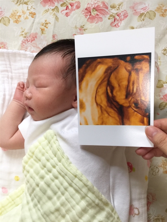 宝宝出生两周和四维B超照片对比