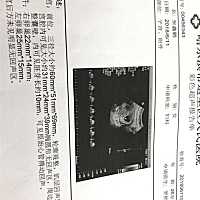 谢谢专业人士帮我看看，能看出来是男孩女孩吗