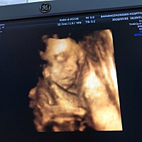 哈哈哈 五次终于看见你了 能不能是双眼皮呢