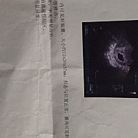 末次月经是5.14来的 ，但是期间一直在吃寻麻疹药（盐酸非索非那定） ，第一次怀孕不知道宝宝到底好不好...