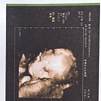 很像姐姐，妈妈很开心见到你，无论男女妈妈只希望你健康成长