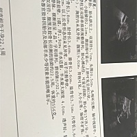 热腾腾的二维排畸折腾一上午的时间，谁会看一下性别