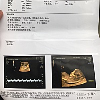 看得出是男孩还是女孩吗？