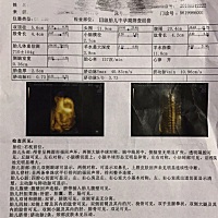 感觉是女儿，不知道对不对