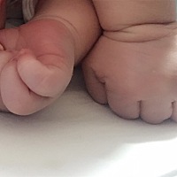 农历5.20出生，宫颈撕裂2处，会阴撕裂一处，侧切一刀，后有大出血，还好，我挺过来了，要相信自己