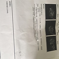 有做过卵泡监测的吗？这个月有戏吗？第11天监测的