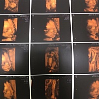 今天去拍四维了，大家帮看看是女宝宝还是男宝宝啊，好奇