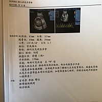 帮忙看下男孩女孩？