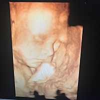 大家都说这是女孩的脸呢……像爸爸的应该是女孩没错了吧？