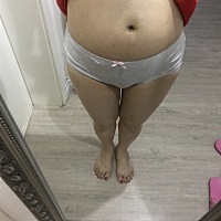 疯掉了，这个月打的促排卵针，从头到位一共打了8针，现在肚子涨成这样，像气球一样，像怀孕5个月一样，...