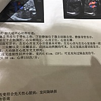 宝宝检查心脏有个缺，好担心，医生说后期可能会长好、希望宝宝能健健康康的🙏
