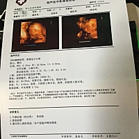 纯属好奇 有经验的宝妈能帮忙看看男孩女孩吗 🙏