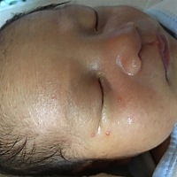 请问一下宝宝眼睛下面发青是什么缘故