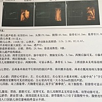 有会看四维彩超单子的吗？头胎、比较好奇男娃还是女娃！