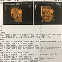 有没有宝妈会看男孩女孩的？