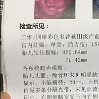 要不要再试一次，再确认一次你是完好的。也许有奇迹出现呢？为什么这样的几率会让我摊上了。我觉得不公...