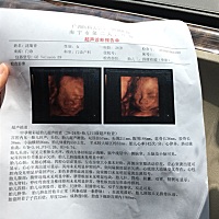 哈哈😄，四维通过啦。觉得宝宝长得好丑哈哈😄。不知道是不是女宝宝 ^_^