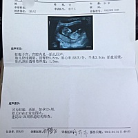 大家猜下男女 已经问过医生🤗