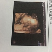 四维彩超今天做完，一次性通过，很开心，可是宝宝的照片不完美，只有一张还捂脸，嘻嘻