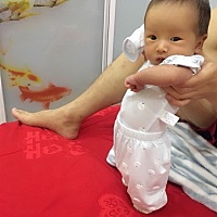 孕期和月子里一直喝很多水 吃很多水果 咋还是痔疮了，怎么办啊 我也没成天卧床不动啊