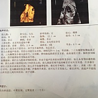 男孩女孩谁会看啊、