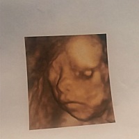 你们觉得像男孩还是女孩？我老公是藏族的。我是汉族的