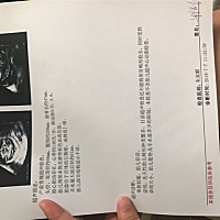 每次减都小于二，为嘛这次大于二？为娘的甚是不懂……