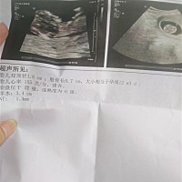 刚做完NT，看得出男女吗？