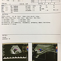 刚做的四维，哪位宝妈会看男宝还是女宝？对着百度了半天，看不懂，好好奇