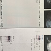 宝妈们，看三个数据能看男女么？帮忙看下😊